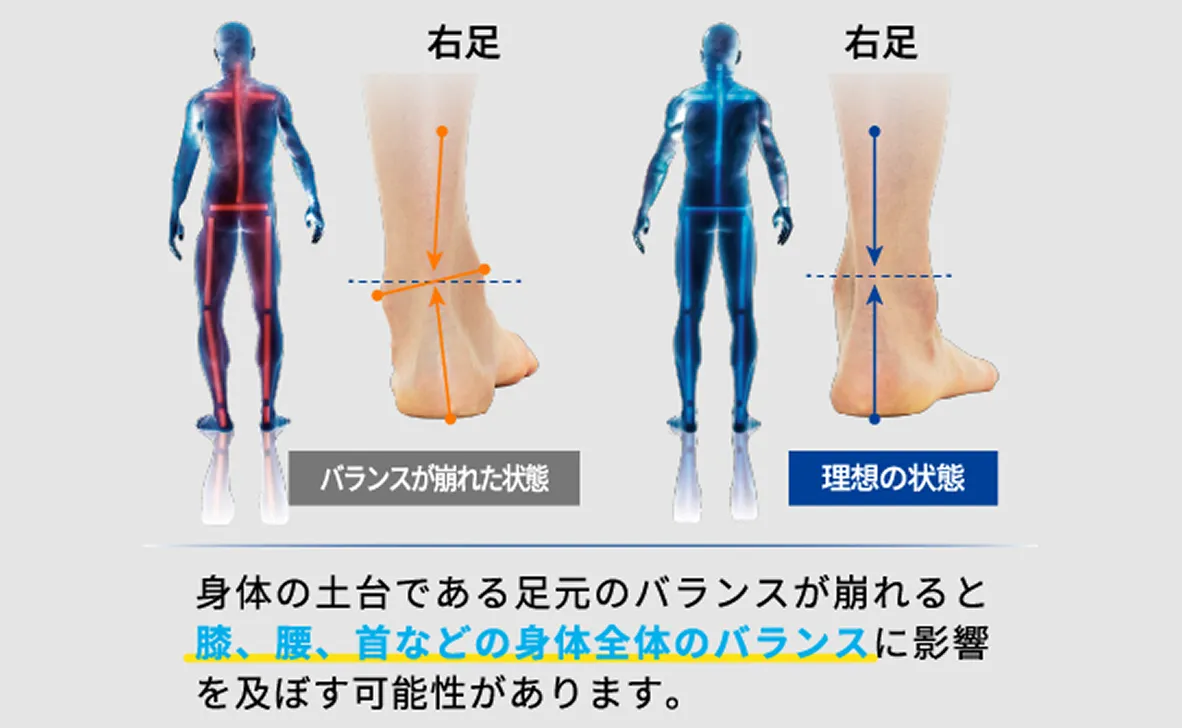 身体の土台である足元のバランスが崩れると膝、腰、首などの身体全体のバランスに影響を及ぼす可能性があります。
